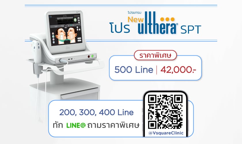 โปร_SPT