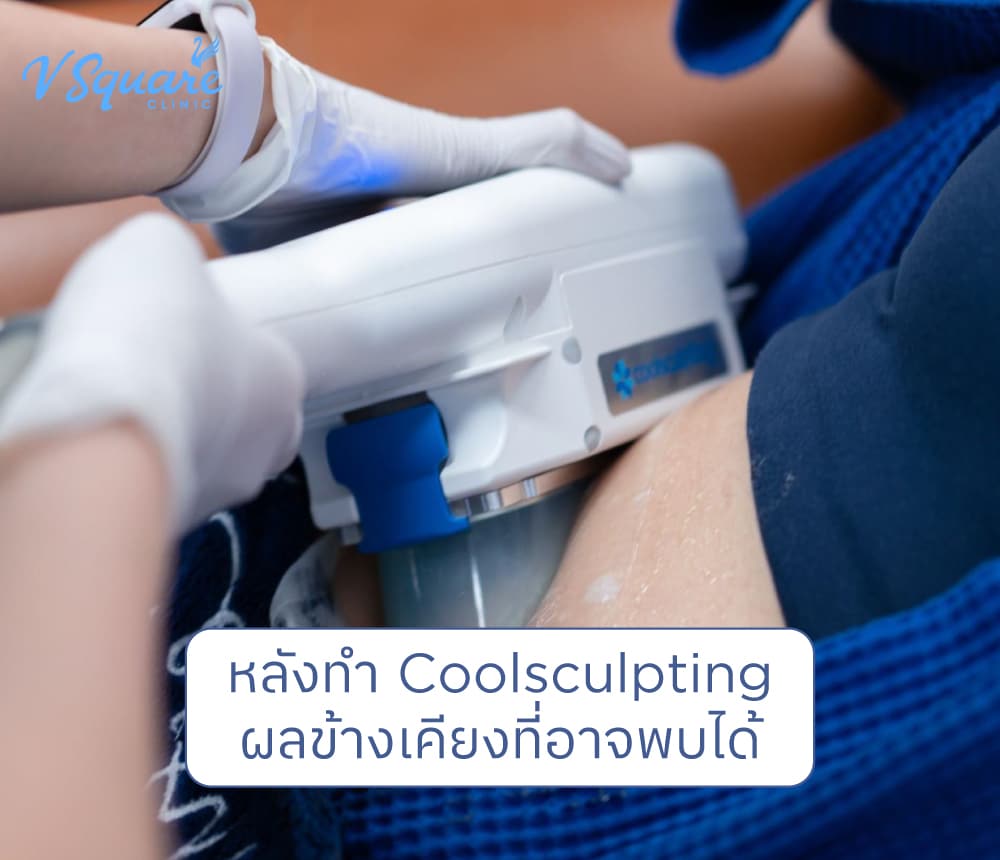 Coolsculpting ผลข้างเคียง