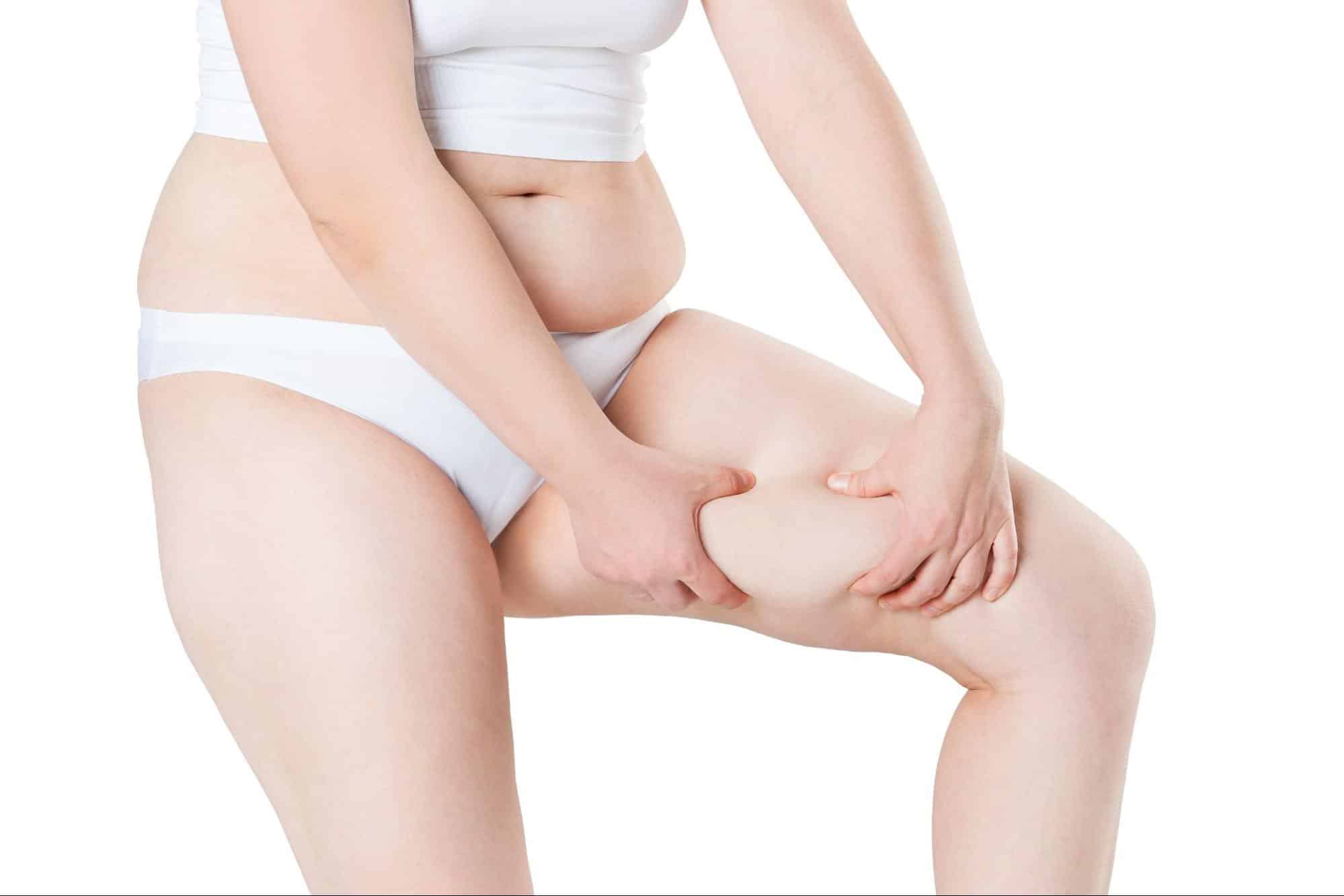 Coolsculpting สลายไขมันต้นขา เหมาะกับใคร