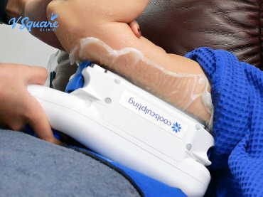 Coolsculpting สลายไขมันต้นแขน 370x277