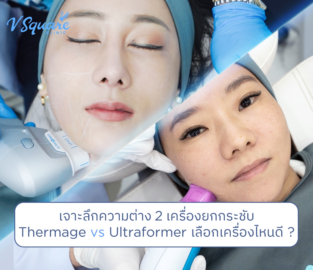 Thermage vs Ultraformer