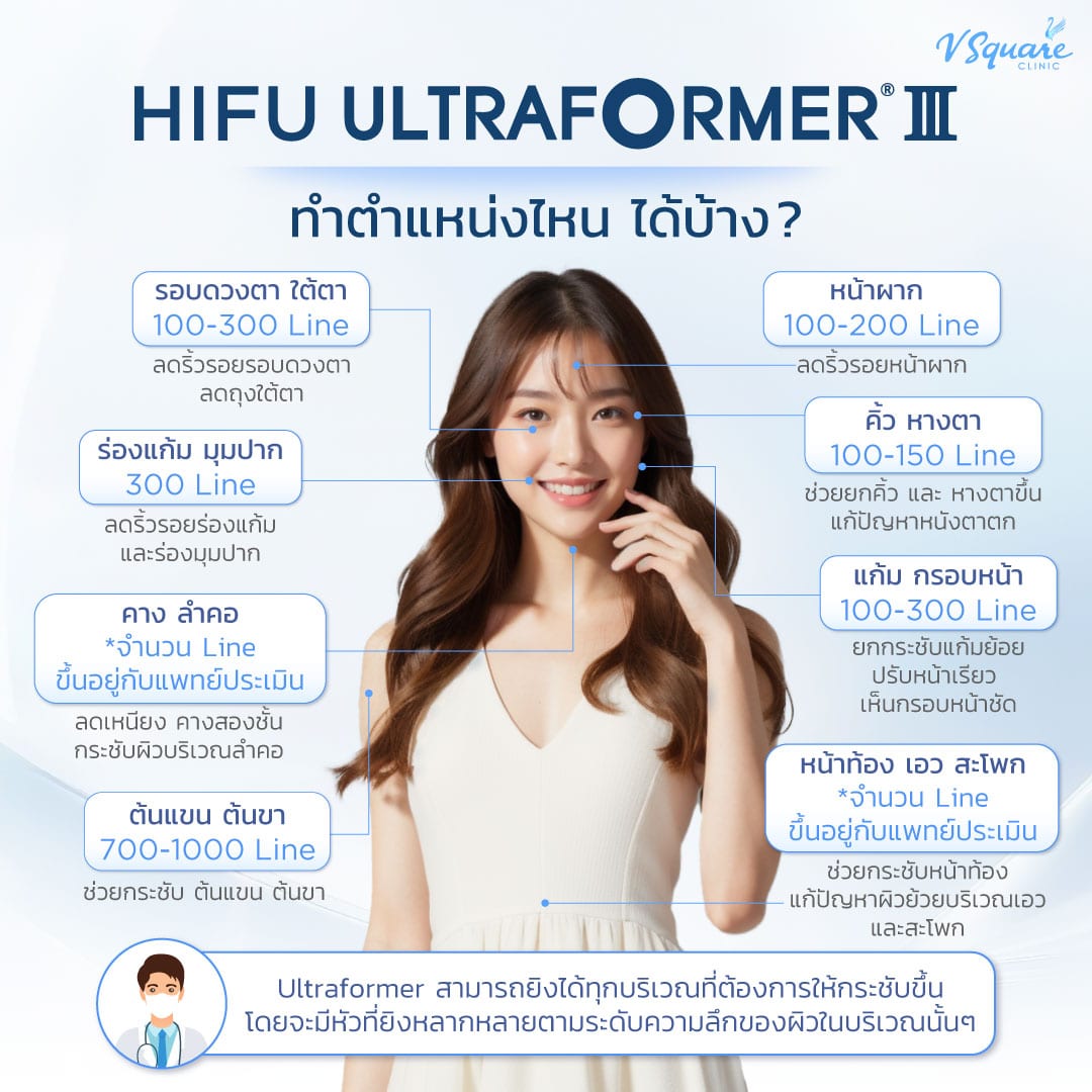 Ultraformer III ทำตำแหน่งไหนได้บ้าง