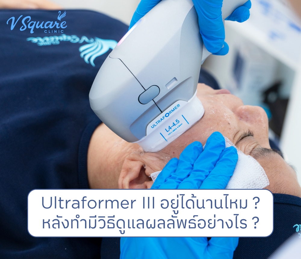 Ultraformer III อยู่ได้นานไหม
