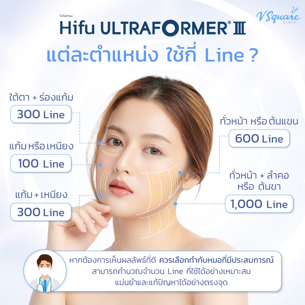 Ultraformer III ใช้กี่ไลน์