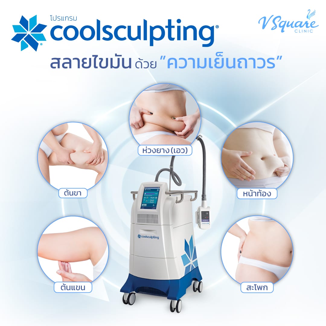 สลายไขมัน Coolsculpting ตำแหน่ง