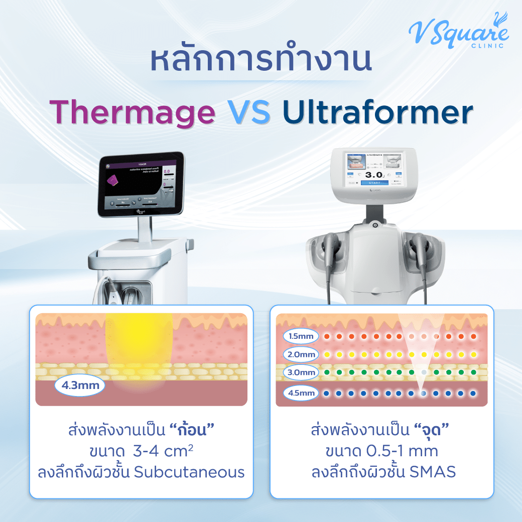หลักการทำงาน Thermage vs Ultraformer