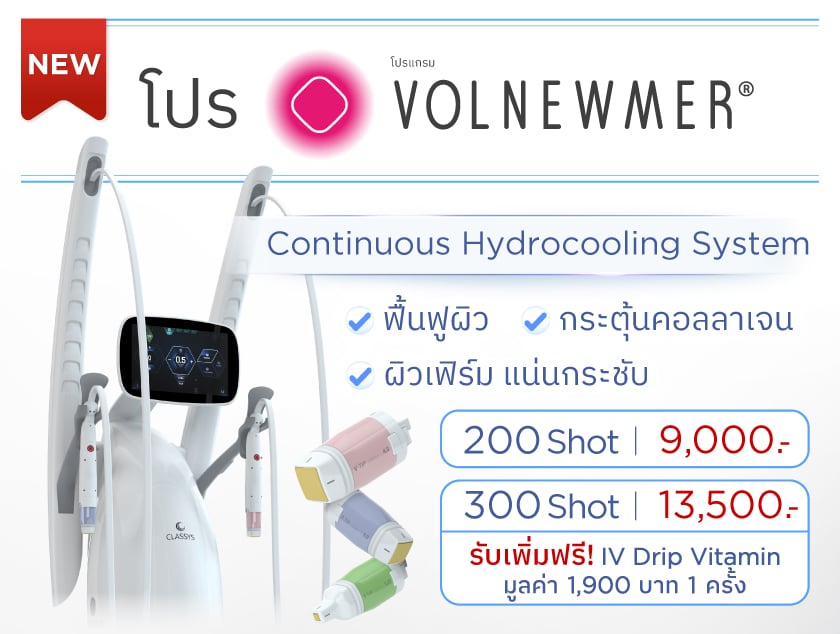 โปรโมชั่น volnewmer